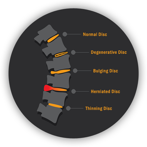 b1-back-pain-spine-graphic